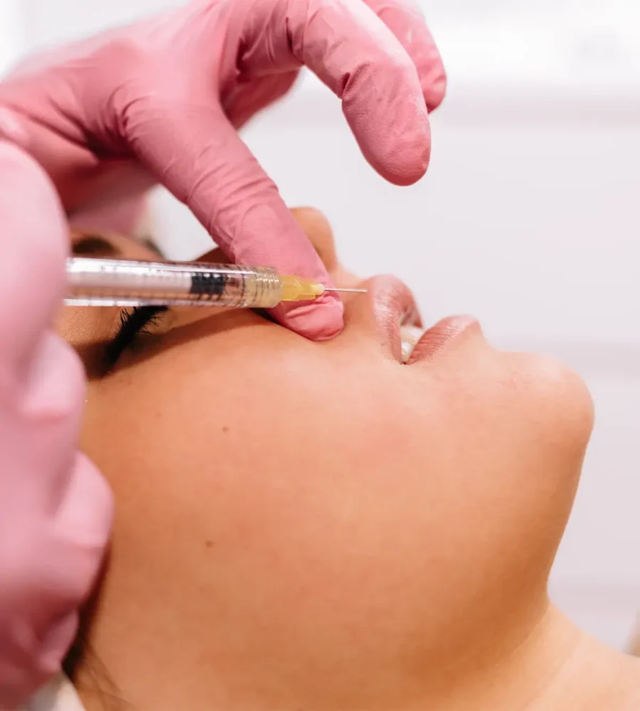Dermal Fillers